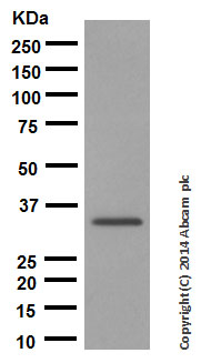 Western blot - Anti-proNGF antibody [EP1320Y] (AB52918), expandable thumbnail