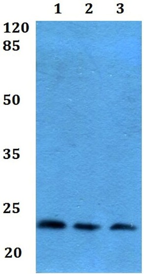 Western blot - Anti-Prostaglandin D Synthase (hematopoietic) antibody (AB192360)