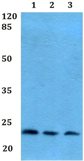 Western blot - Anti-Prostaglandin D Synthase (hematopoietic) antibody (AB192360)