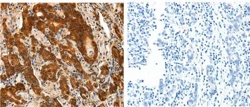 Immunohistochemistry (Formalin/PFA-fixed paraffin-embedded sections) - Anti-Prostaglandin D Synthase (Lipocalin)/PDS antibody (AB182784)