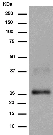 Western blot - Anti-Prostaglandin D Synthase (Lipocalin)/PDS antibody [EP12357] (AB182141)