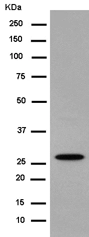 Western blot - Anti-Prostaglandin D Synthase (Lipocalin)/PDS antibody [EP12357] (AB182141)