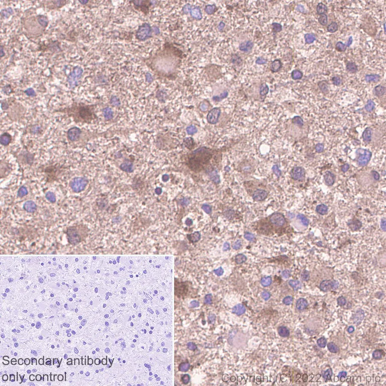 Immunohistochemistry (Formalin/PFA-fixed paraffin-embedded sections) - Anti-Prostaglandin D Synthase (Lipocalin)/PDS antibody [EP12357] - BSA and Azide free (AB236119)