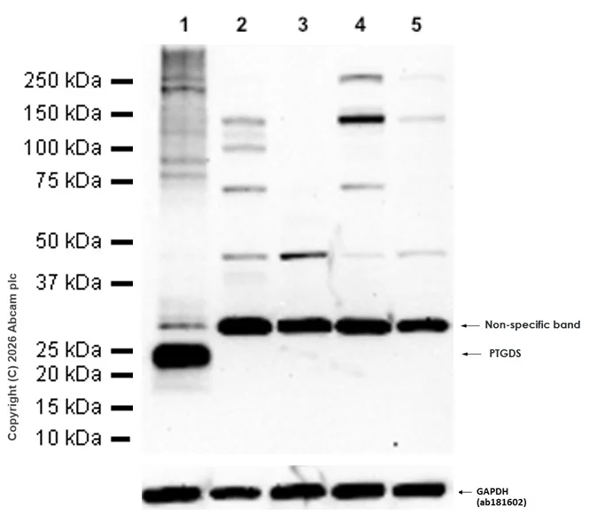 Western blot - Anti-Prostaglandin D Synthase (Lipocalin)/PDS antibody [EP12357] - BSA and Azide free (AB236119)