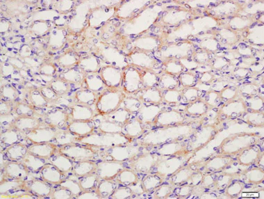 Immunohistochemistry (Formalin/PFA-fixed paraffin-embedded sections) - Anti-Prostaglandin E Receptor EP1/PTGER1 antibody (AB217925)