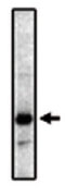 Western blot - Anti-Prostaglandin E Receptor EP2/PTGER2 antibody [3E6] (AB16151)