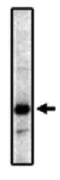 Western blot - Anti-Prostaglandin E Receptor EP2/PTGER2 antibody [3E6] (AB16151)