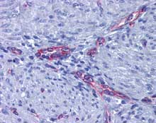 Immunohistochemistry (Formalin/PFA-fixed paraffin-embedded sections) - Anti-Prostaglandin E Receptor EP2/PTGER2 antibody (AB124419), expandable thumbnail