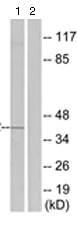 Western blot - Anti-Prostaglandin E Receptor EP2/PTGER2 antibody (AB124419)
