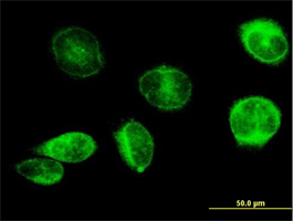 Immunocytochemistry/ Immunofluorescence - Anti-Prostaglandin E Synthase/MPGES-1 antibody (AB168621)