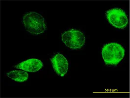 Immunocytochemistry/ Immunofluorescence - Anti-Prostaglandin E Synthase/MPGES-1 antibody (AB168621)