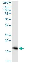 Western blot - Anti-Prostaglandin E Synthase/MPGES-1 antibody (AB168621)