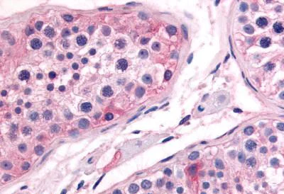 Immunohistochemistry (Formalin/PFA-fixed paraffin-embedded sections) - Anti-Prostaglandin E Synthase/MPGES-1 antibody (AB62050)