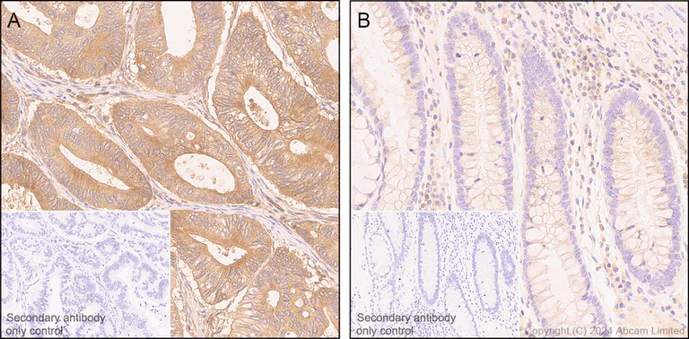 Immunohistochemistry (Formalin/PFA-fixed paraffin-embedded sections) - Anti-Prostaglandin E2/1 antibody [EPR25228-27] (AB323269)