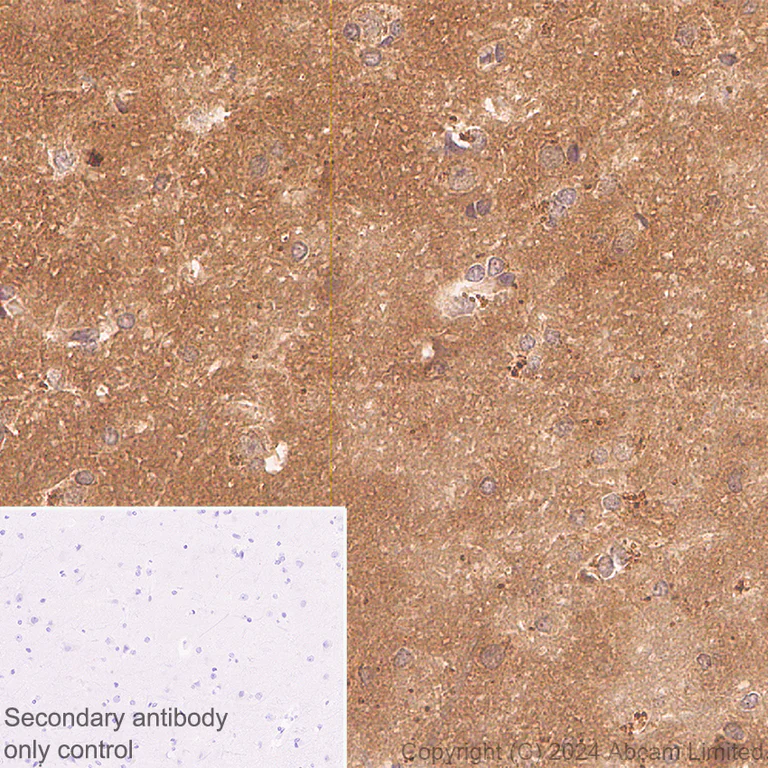 Immunohistochemistry (Formalin/PFA-fixed paraffin-embedded sections) - Anti-Prostaglandin E2/1 antibody [EPR25228-27] (AB323269)