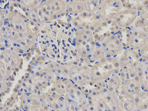 Immunohistochemistry (Formalin/PFA-fixed paraffin-embedded sections) - Anti-Prostate Secretory Protein/PSP antibody (AB196754)