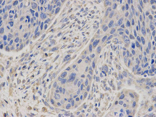 Immunohistochemistry (Formalin/PFA-fixed paraffin-embedded sections) - Anti-Prostate Secretory Protein/PSP antibody (AB196754)