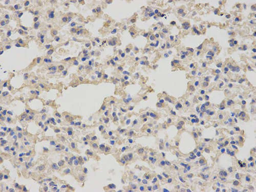 Immunohistochemistry (Formalin/PFA-fixed paraffin-embedded sections) - Anti-Prostate Secretory Protein/PSP antibody (AB196754)