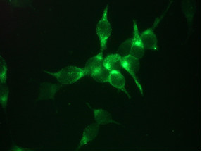 Immunocytochemistry/ Immunofluorescence - Anti-Prostate Specific Antigen antibody [3E6] (AB140337)