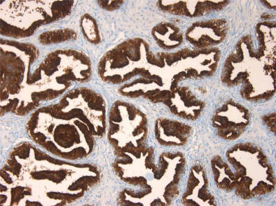 Immunohistochemistry (Formalin/PFA-fixed paraffin-embedded sections) - Anti-Prostate Specific Antigen antibody [3E6] (AB140337)