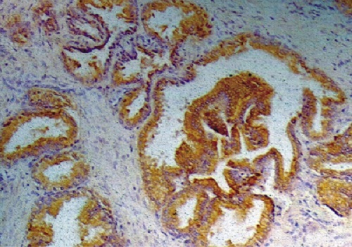Immunohistochemistry (Formalin/PFA-fixed paraffin-embedded sections) - Anti-Prostate Specific Antigen antibody [A67-B/E3] (AB2218), expandable thumbnail