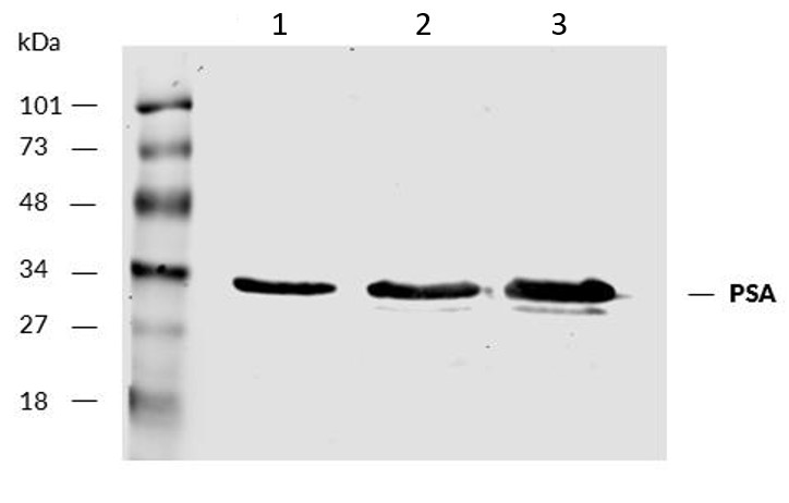 Western blot - Anti-Prostate Specific Antigen antibody [A67-B/E3] (AB2218), expandable thumbnail
