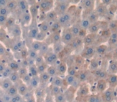 Immunohistochemistry (Formalin/PFA-fixed paraffin-embedded sections) - Anti-Prostate Specific Antigen antibody (AB231238), expandable thumbnail