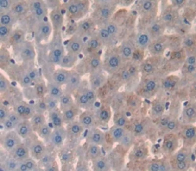 Immunohistochemistry (Formalin/PFA-fixed paraffin-embedded sections) - Anti-Prostate Specific Antigen antibody (AB231238)