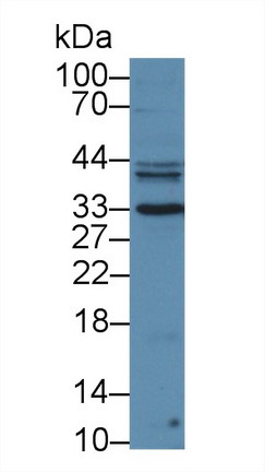 Western blot - Anti-Prostate Specific Antigen antibody (AB231238), expandable thumbnail