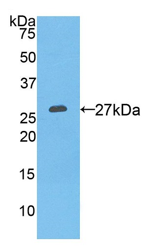 Western blot - Anti-Prostate Specific Antigen antibody (AB231238), expandable thumbnail