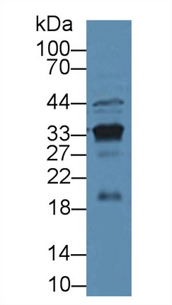 Western blot - Anti-Prostate Specific Antigen antibody (AB231238), expandable thumbnail