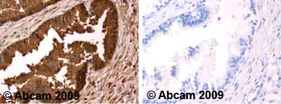 Immunohistochemistry (Formalin/PFA-fixed paraffin-embedded sections) - Anti-Prostate Specific Antigen antibody (AB53774), expandable thumbnail