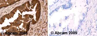 Immunohistochemistry (Formalin/PFA-fixed paraffin-embedded sections) - Anti-Prostate Specific Antigen antibody (AB53774)