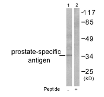 Western blot - Anti-Prostate Specific Antigen antibody (AB53774), expandable thumbnail