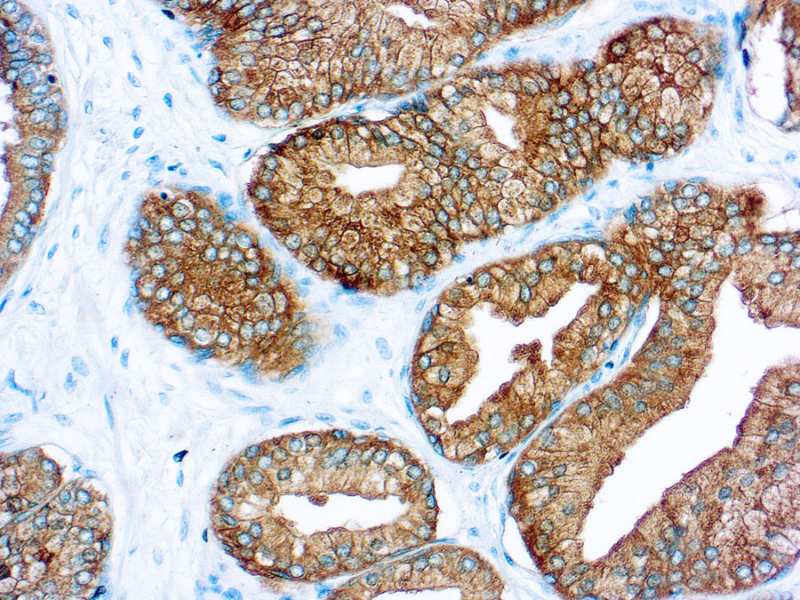 Immunohistochemistry (Formalin/PFA-fixed paraffin-embedded sections) - Anti-Prostate Specific Antigen antibody (AB9537)