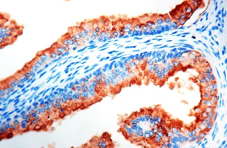 Immunohistochemistry (Formalin/PFA-fixed paraffin-embedded sections) - Anti-Prostate Specific Antigen antibody (AB9537)
