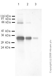 Western blot - Anti-Prostate Specific Antigen antibody - Catalytic domain (AB40949)