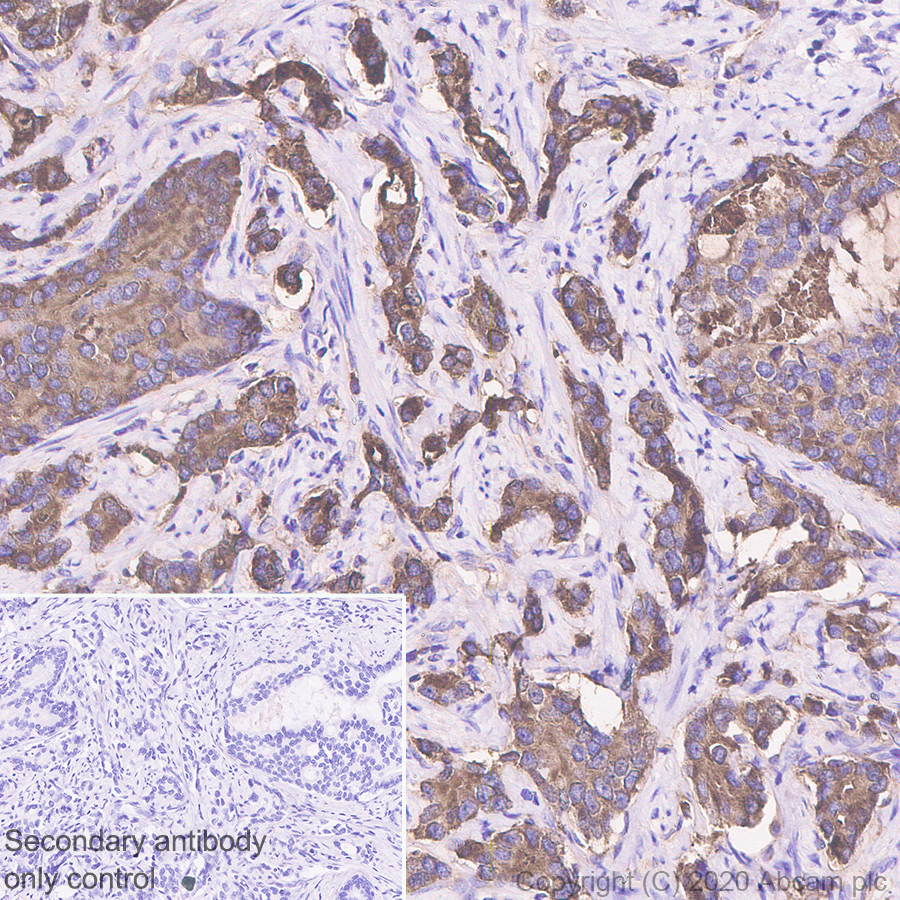 Immunohistochemistry (Formalin/PFA-fixed paraffin-embedded sections) - Anti-Prostate Specific Antigen antibody [EP1588Y] (AB76113), expandable thumbnail