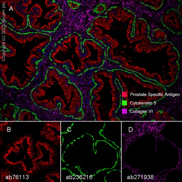 Multiplex immunohistochemistry - Anti-Prostate Specific Antigen antibody [EP1588Y] (ab76113), expandable thumbnail