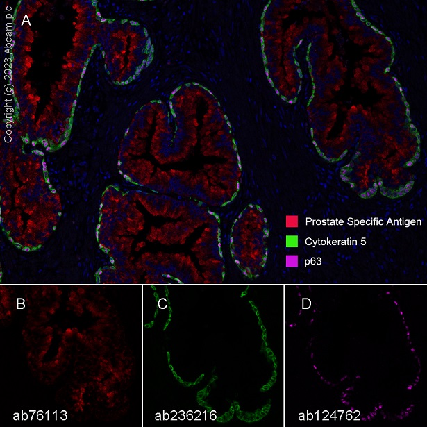 Multiplex immunohistochemistry - Anti-Prostate Specific Antigen antibody [EP1588Y] (ab76113), expandable thumbnail