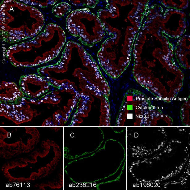 Multiplex immunohistochemistry - Anti-Prostate Specific Antigen antibody [EP1588Y] (AB76113), expandable thumbnail