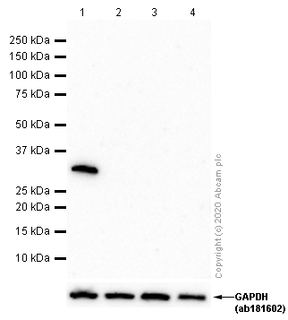 Western blot - Anti-Prostate Specific Antigen antibody [EP1588Y] (AB76113), expandable thumbnail