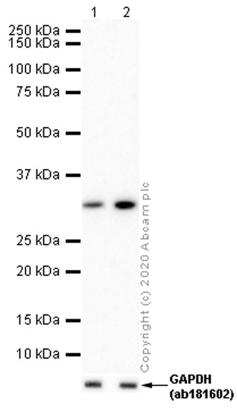 Western blot - Anti-Prostate Specific Antigen antibody [EP1588Y] (AB76113), expandable thumbnail