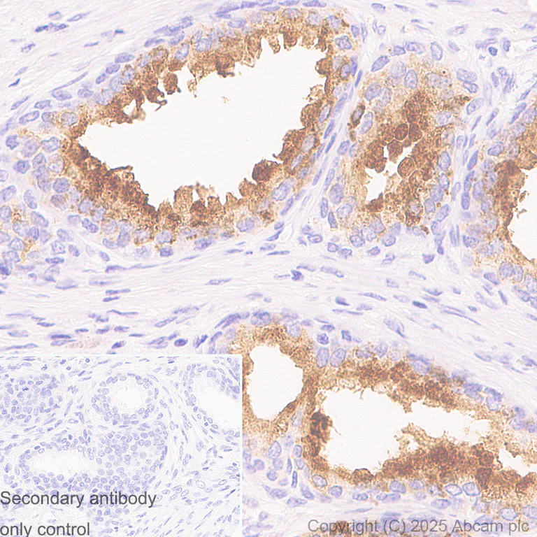 Immunohistochemistry (Formalin/PFA-fixed paraffin-embedded sections) - Anti-Prostate Specific Antigen antibody [EPR22271-97] - BSA and Azide free (Capture) (AB242191)