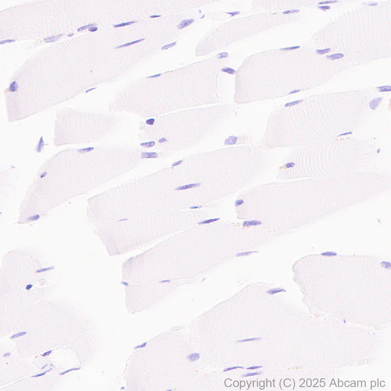 Immunohistochemistry (Formalin/PFA-fixed paraffin-embedded sections) - Anti-Prostate Specific Antigen antibody [EPR22271-97] - BSA and Azide free (Capture) (AB242191)