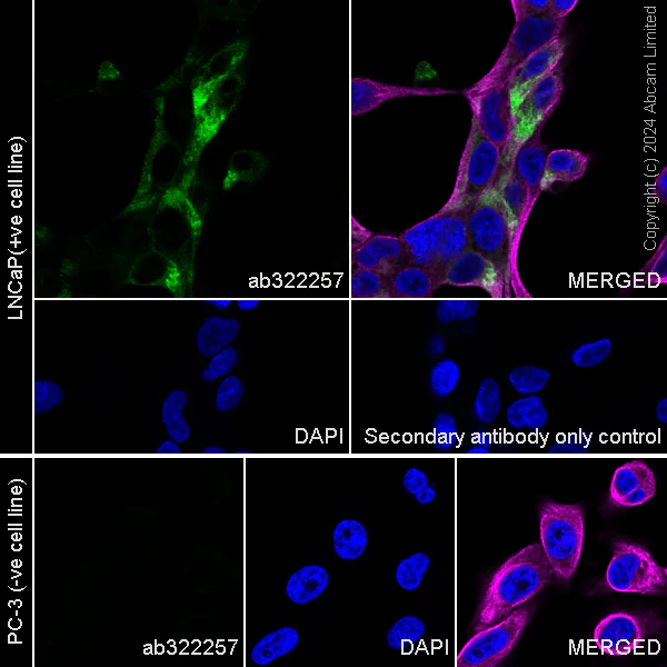 Immunocytochemistry/ Immunofluorescence - Anti-Prostate Specific Antigen antibody [RM1268] (AB322442)