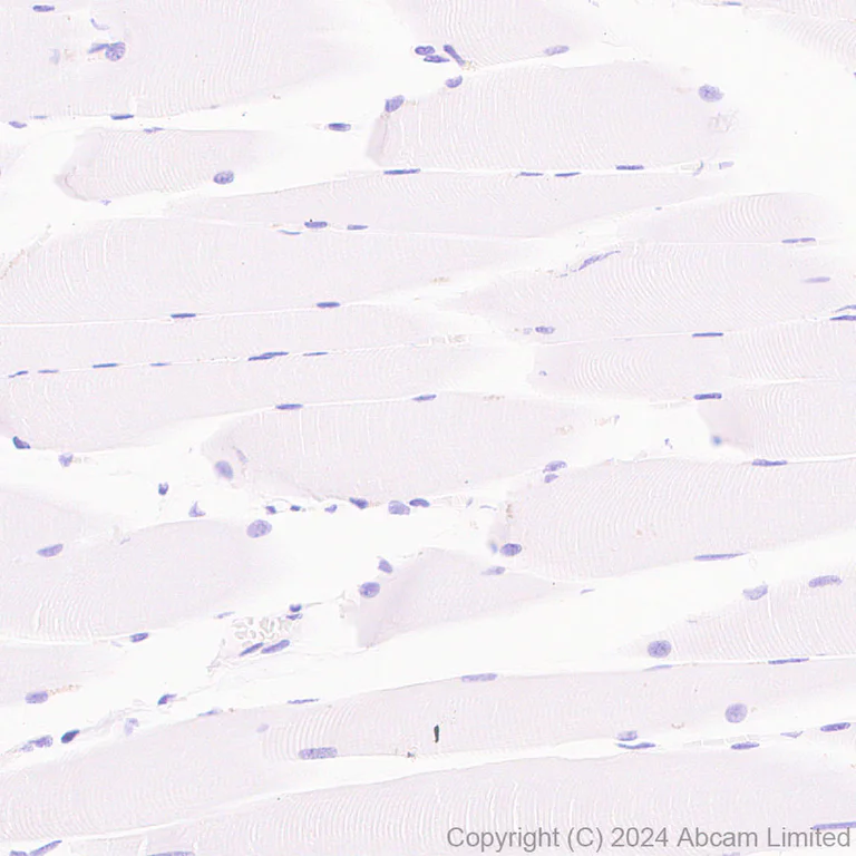 Immunohistochemistry (Formalin/PFA-fixed paraffin-embedded sections) - Anti-Prostate Specific Antigen antibody [RM1268] (AB322442)