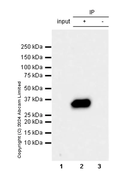 Immunoprecipitation - Anti-Prostate Specific Antigen antibody [RM1268] (AB322442)