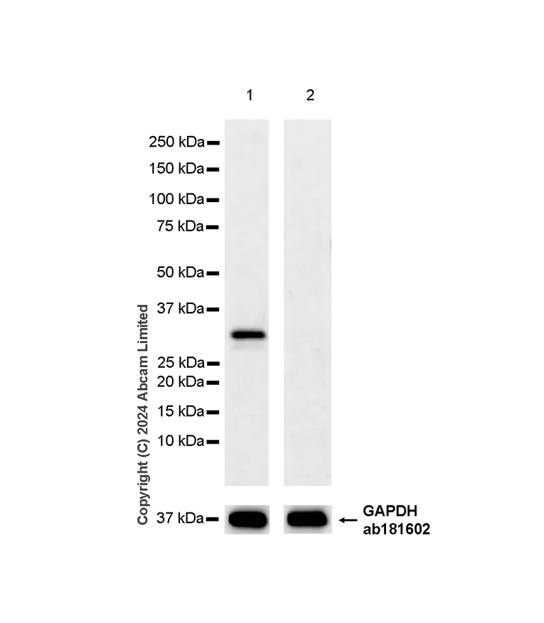 Western blot - Anti-Prostate Specific Antigen antibody [RM1268] (AB322442)