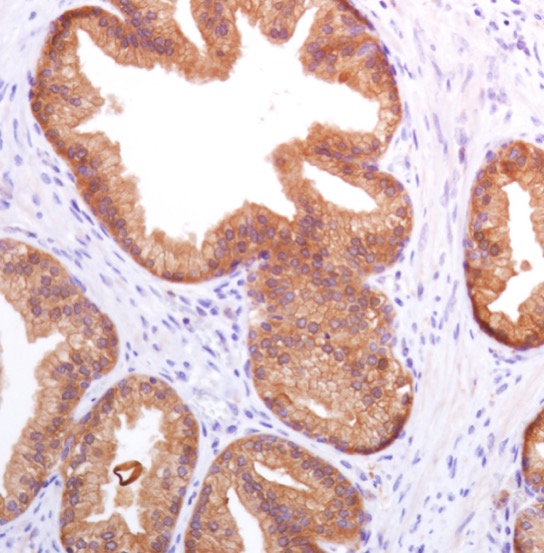 Immunohistochemistry (Formalin/PFA-fixed paraffin-embedded sections) - Anti-Prostate Specific Antigen antibody [SP317] (AB224799)